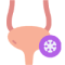 interstitial cystitis